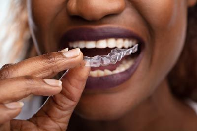 woman putting in her new clear aligners that she received from Uptown Family Dental