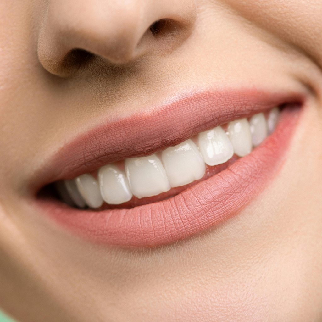 Who Benefits Most from Routine Dental Cleaning